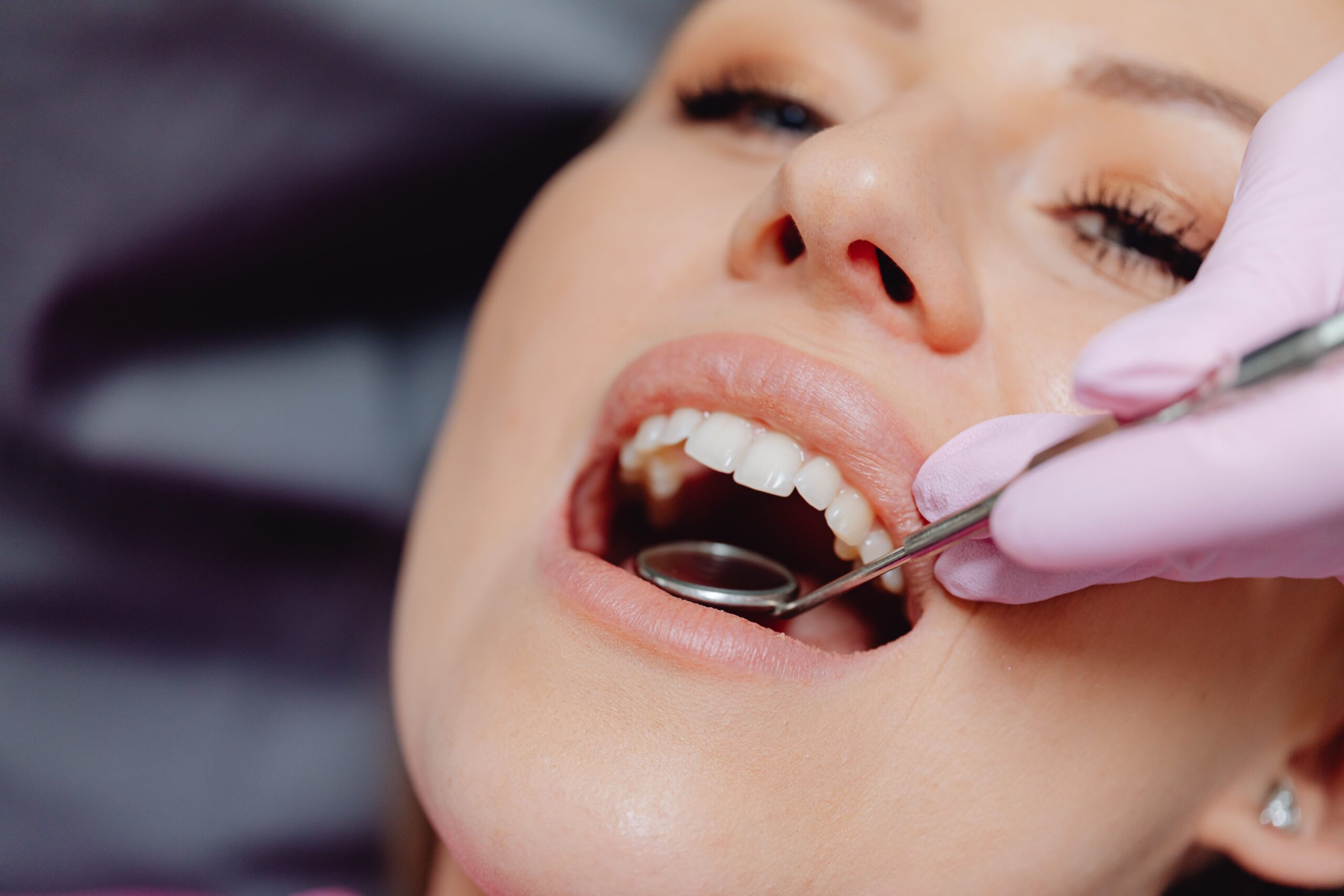 best periodontist in mylapore-services