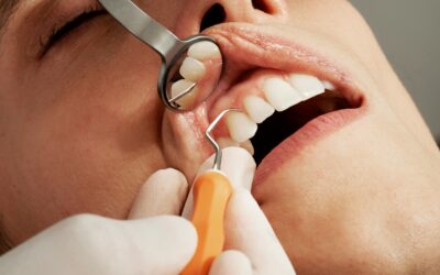 Why Bleeding Gums Need Immediate Attention from a Periodontist